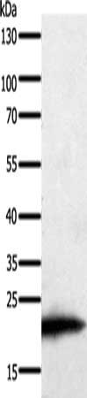 Anti-PARK7 Antibody