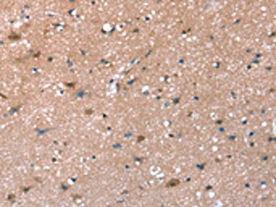 Anti-SYNPO / Synaptopodin Antibody