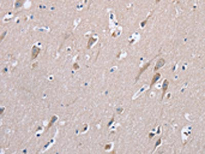 Anti-STMN1 / Stathmin Antibody