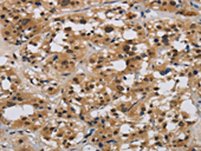 Anti-E2F4 / Transcription factor E2F4 Antibody
