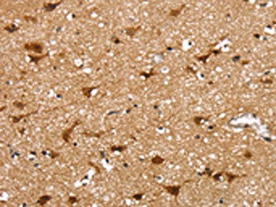 Anti-SSBP4 Antibody