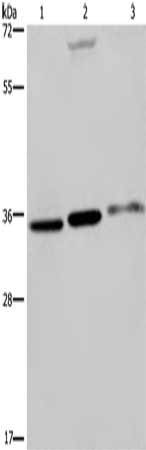 Anti-PITX2 Antibody