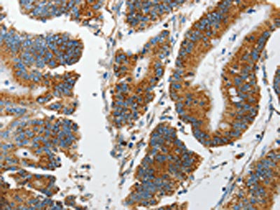 Anti-MARK2 Antibody