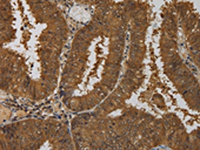 Anti-TAB1 / TGF-beta-activated kinase 1 and MAP3K7 binding protein 1 Antibody