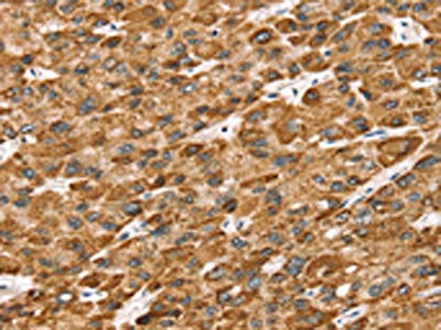 Anti-STK32B / Serine threonine-protein kinase 32B Antibody