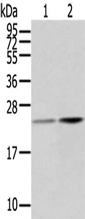 Anti-RBP4 Antibody