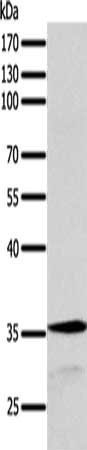 Anti-SYT9 / Synaptotagmin 9 Antibody