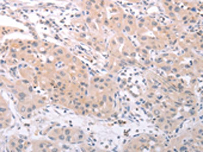 Anti-SPATA16 Antibody