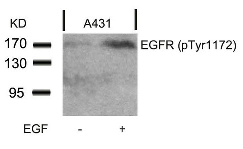 Anti-Phospho-EGFR (Tyr1172) Antibody