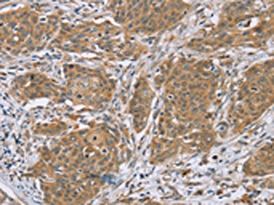 Anti-RNF139 Antibody