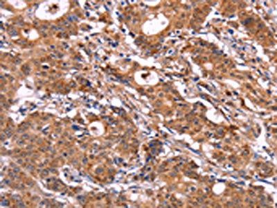 Anti-SIGLEC5 Antibody