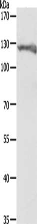 Anti-PC Antibody