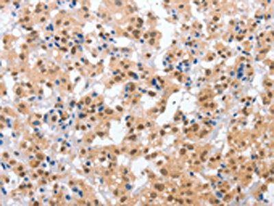 Anti-CPSF4 Antibody