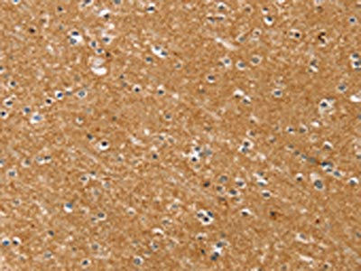 Anti-SYTL5 / Synaptotagmin like protein 5 Antibody