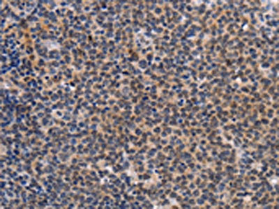 Anti-POU4F1 Antibody