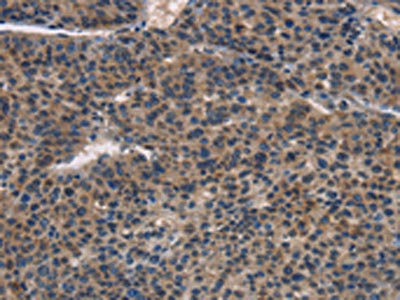 Anti-IRF3 / Interferon regulatory factor 3 Antibody