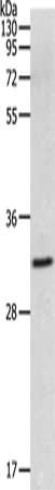 Anti-MMP26 Antibody