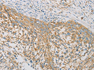 Anti-REN Antibody