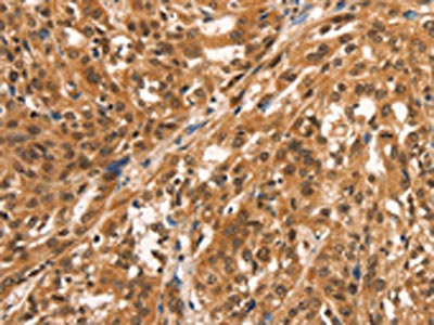 Anti-CCNE2 / Cyclin E2 Antibody