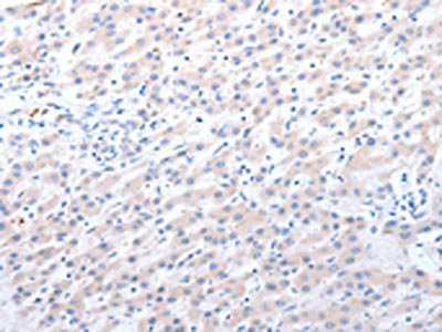 Anti-ALDH1 A1/2/3 Antibody
