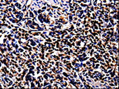 Anti-S100A4 Antibody