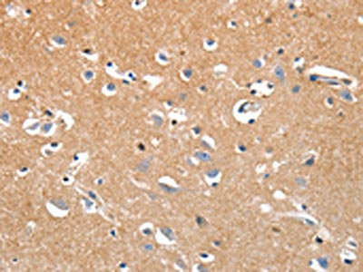 Anti-LRP3 Antibody