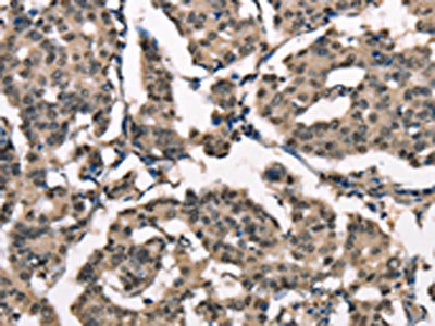 Anti-NDNL2 Antibody