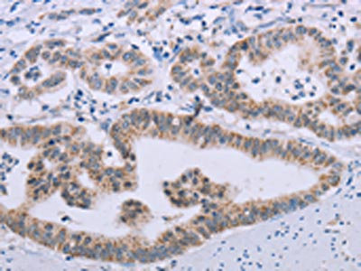 Anti-MRGPRX1 Antibody