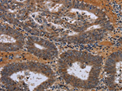 Anti-JMJD7 Antibody