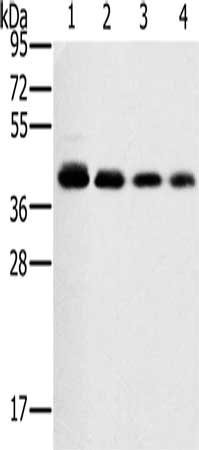 Anti-PTGER1 Antibody
