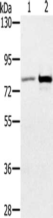 Anti-CARF Antibody