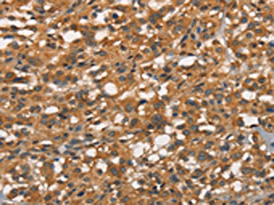Anti-APOC4 / Apolipoprotein C4 Antibody