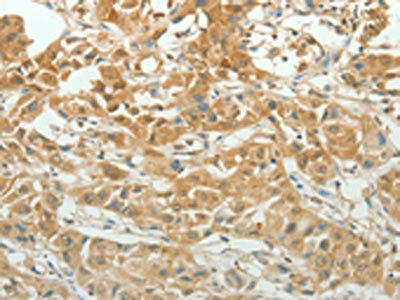 Anti-PAX5 Antibody