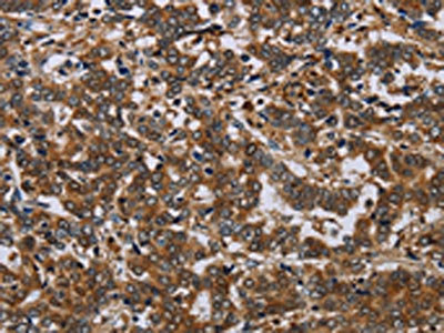 Anti-NCKAP1 Antibody