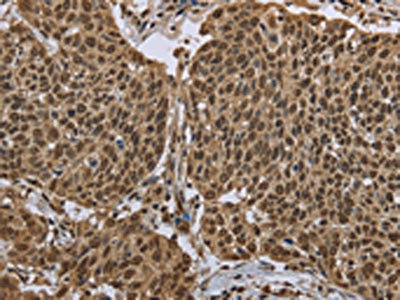 Anti-PPAT Antibody