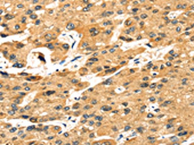 Anti-STX8 / Syntaxin 8 Antibody