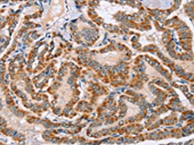 Anti-MSMB Antibody