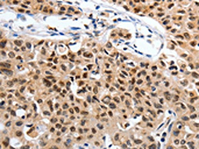 Anti-SUMO1 / Small ubiquitin-related modifier 1 Antibody