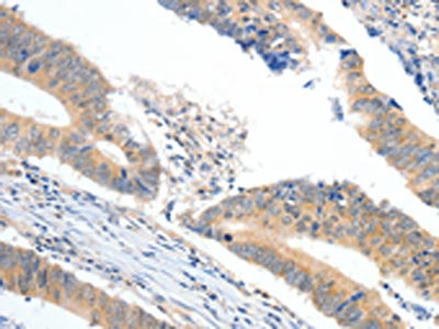 Anti-APOB / Apolipoprotein B-100 Antibody
