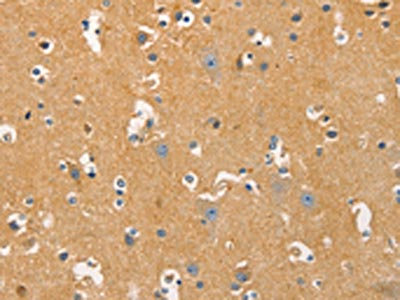 Anti-DNM3 / Dynamin-3 Antibody