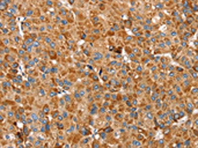 Anti-SSBP1 Antibody