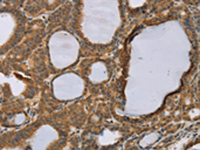 Anti-RNF5 Antibody