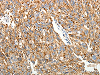 Anti-COL4A3 Antibody
