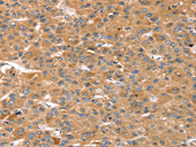 Anti-CAPN7 / Calpain 7 Antibody