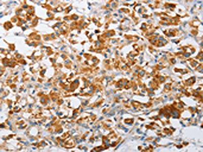 Anti-ARHGEF9 / Rho guanine nucleotide exchange factor 9 Antibody