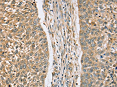 Anti-RASSF4 Antibody