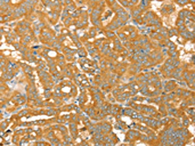 Anti-PTPN22 Antibody
