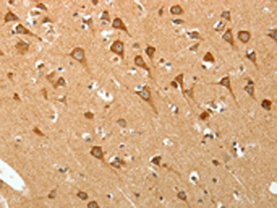Anti-PGBD5 Antibody