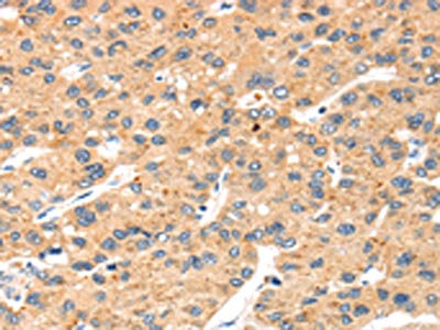 Anti-SLC8B1 Antibody