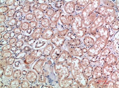 Anti-CD300E Antibody
